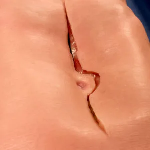 AAA Torso Simulator Midline Incision