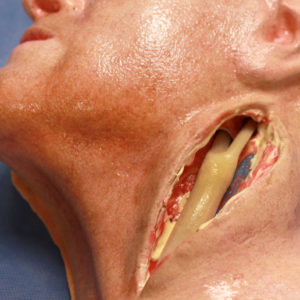 Closeup of Carotid Head Simulator with Artery