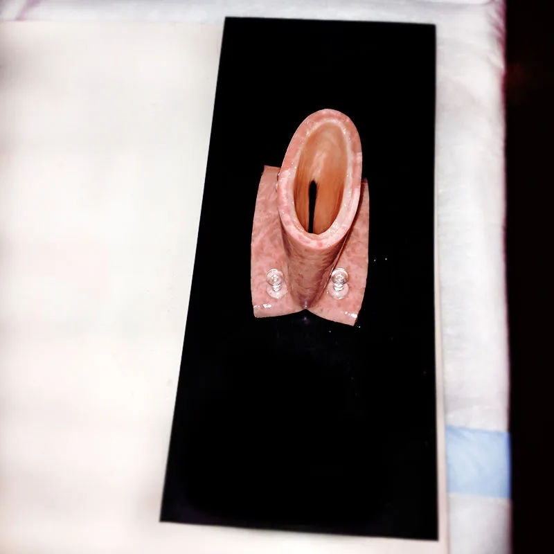 Tissue Mounting Pad - Vaginal Cuff