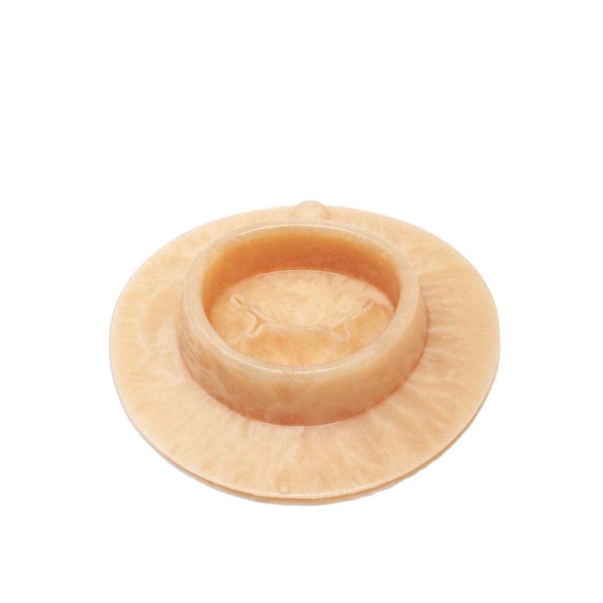 Mitral Valve
