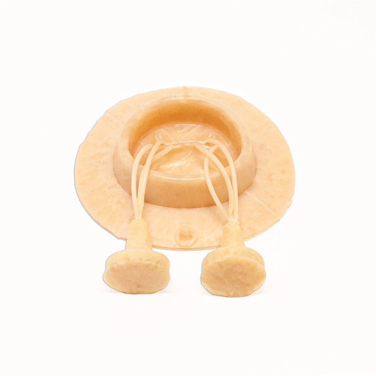 Mitral Valve with Papillaries