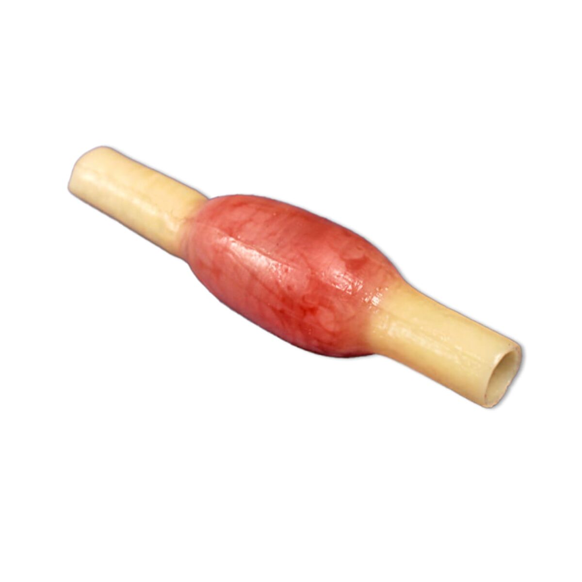 Ectopic Pregnancy Model