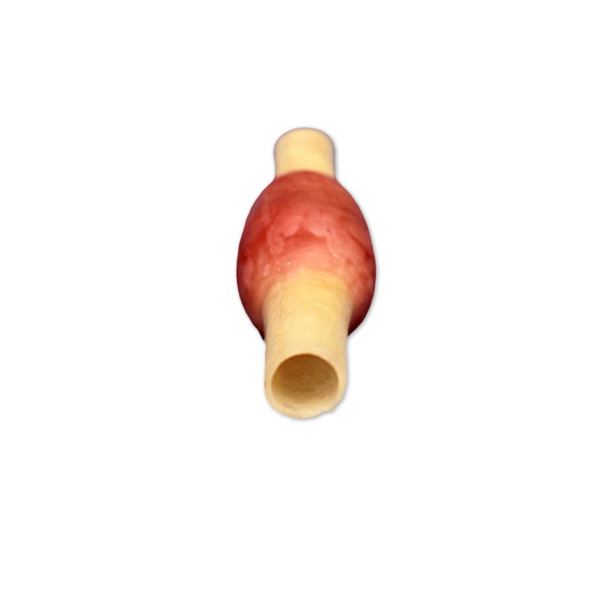 Ectopic Pregnancy Model