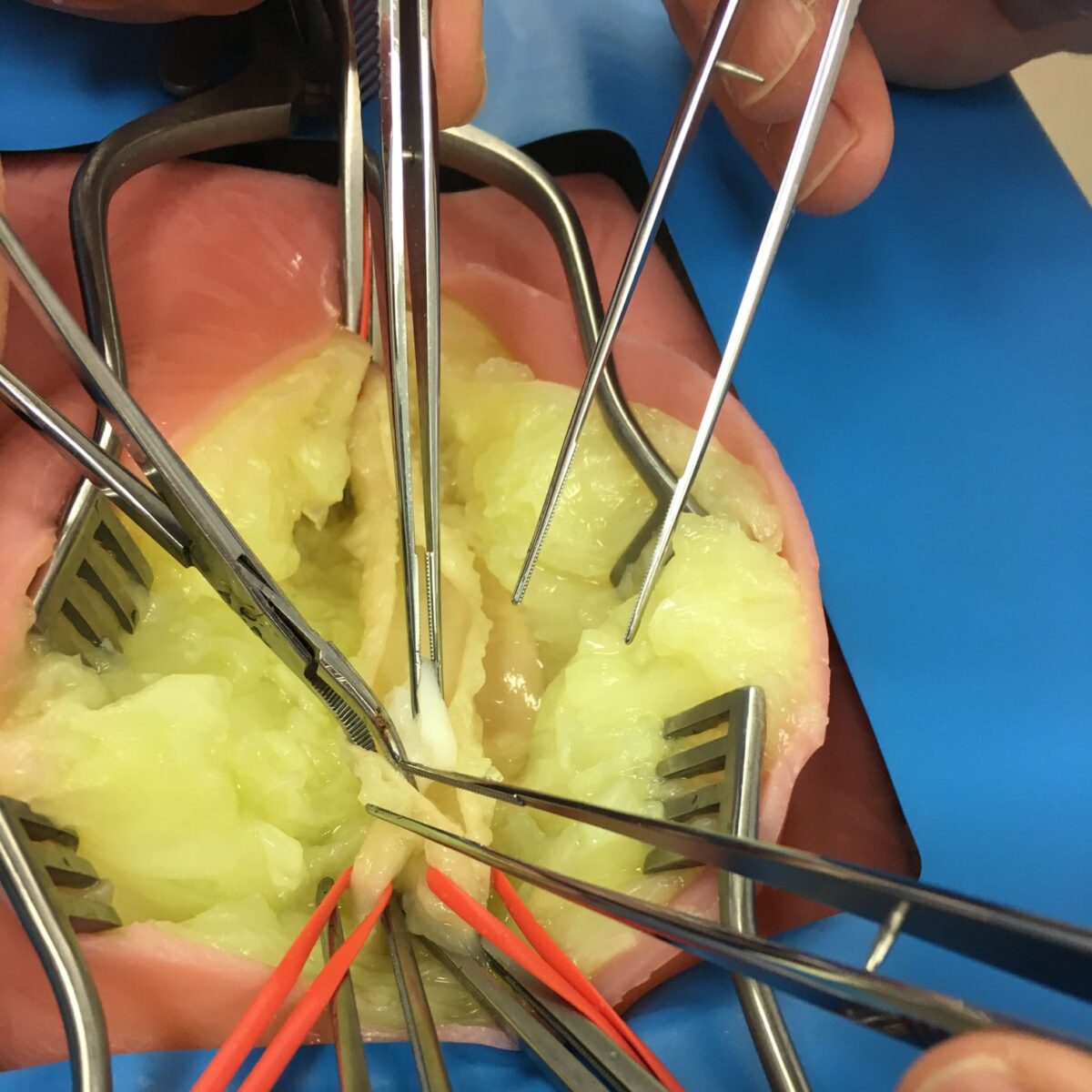 VI Box Surgery Training - Plaque Removal