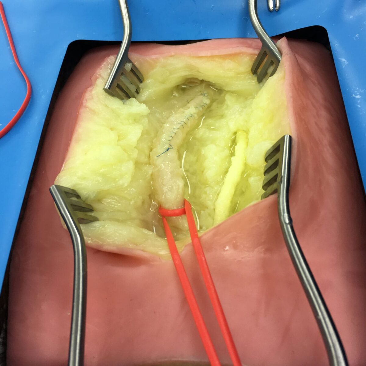 VI Box Surgery 3