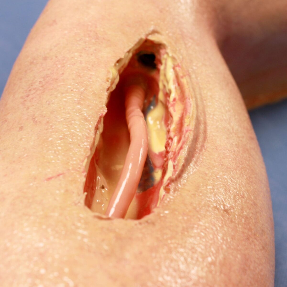 Femoral Leg Simulator Cutout