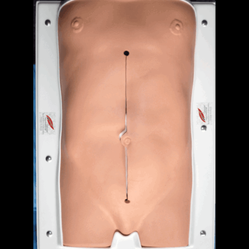 VI AAA Abdominal Aortic Aneurysm Closed Simulator Trainer - Midline incision Endovascular aneurysm repair (EVAR)