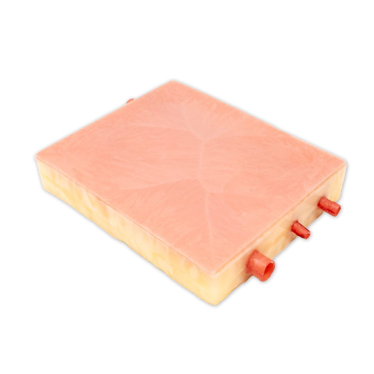 Embedded Carotids with Plaque
